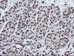 Invitrogen TPD52L3 Monoclonal Antibody (OTI3D11) 100 &mu;L; Unconjugated:Antibodies,
