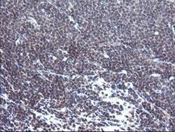Invitrogen TPD52L3 Monoclonal Antibody (OTI3D11) 100 &mu;L; Unconjugated:Antibodies,