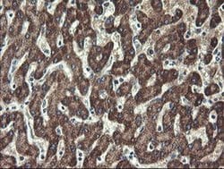 Invitrogen UBE2J1 Monoclonal Antibody (OTI3D1) 100 &mu;L; Unconjugated:Antibodies,