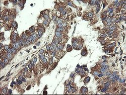 Invitrogen UBE2J1 Monoclonal Antibody (OTI3D1) 100 &mu;L; Unconjugated:Antibodies,