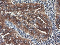 Invitrogen UBE2J1 Monoclonal Antibody (OTI3D1) 100 &mu;L; Unconjugated:Antibodies,