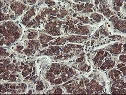 Invitrogen UBE2J1 Monoclonal Antibody (OTI3D1) 100 &mu;L; Unconjugated:Antibodies,
