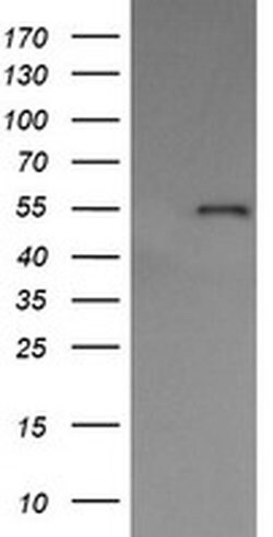 Invitrogen ERp57 Monoclonal Antibody (OTI3E1) 100 &mu;L | Buy Online | Invitrogen&trade; | Fisher Scientific