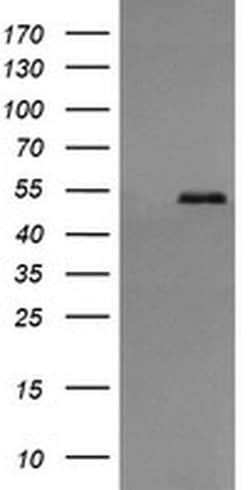 Invitrogen ERp57 Monoclonal Antibody (OTI3H5) 100 &mu;L; Unconjugated:Antibodies,