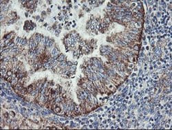 Invitrogen C1orf151 Monoclonal Antibody (OTI4H7) 100 &mu;L; Unconjugated:Antibodies,