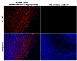 Invitrogen STING Monoclonal Antibody (OTI4E12) 100 &mu;L; Unconjugated:Antibodies,