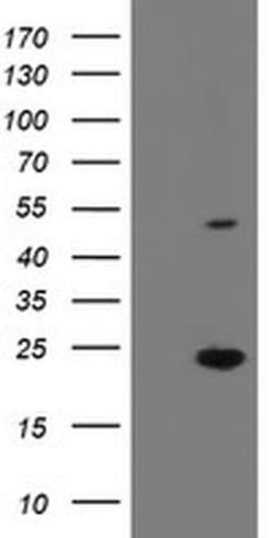 Invitrogen eIF5A2 Monoclonal Antibody (OTI6G7) 100 &mu;L; Unconjugated:Antibodies,