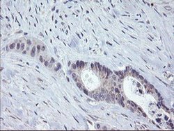 Invitrogen CHN1 Monoclonal Antibody (OTI2D10) 100 &mu;L; Unconjugated:Antibodies,