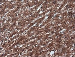 Invitrogen Rhotekin Monoclonal Antibody (OTI2E9) 100 &mu;L; Unconjugated:Antibodies,