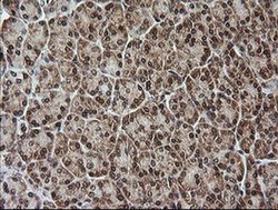 Invitrogen Rhotekin Monoclonal Antibody (OTI2E9) 100 &mu;L; Unconjugated:Antibodies,
