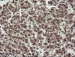 Invitrogen CHN1 Monoclonal Antibody (OTI2G6) 100 &mu;L | Buy Online | Invitrogen&trade; | Fisher Scientific