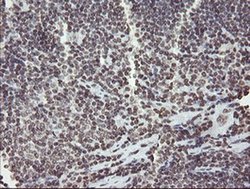 Invitrogen CHN1 Monoclonal Antibody (OTI2G6) 100 &mu;L | Buy Online | Invitrogen&trade; | Fisher Scientific