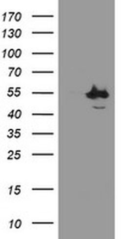 Invitrogen CHN1 Monoclonal Antibody (OTI2G6) 100 &mu;L | Buy Online | Invitrogen&trade; | Fisher Scientific
