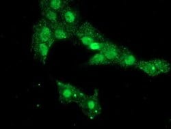 Invitrogen PHF7 Monoclonal Antibody (OTI1A2) 100 &mu;L; Unconjugated:Antibodies,