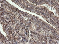 Invitrogen PHF7 Monoclonal Antibody (OTI1A2) 100 &mu;L; Unconjugated:Antibodies,