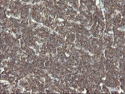 Invitrogen PHF7 Monoclonal Antibody (OTI1A2) 100 &mu;L; Unconjugated:Antibodies,