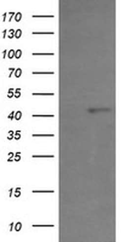 Invitrogen PHF7 Monoclonal Antibody (OTI1A2) 100 &mu;L; Unconjugated:Antibodies,