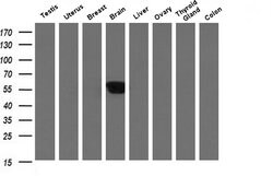 Invitrogen ALX4 Monoclonal Antibody (OTI1F2) 100 &mu;L; Unconjugated:Antibodies,