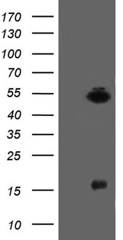 Invitrogen ALX4 Monoclonal Antibody (OTI1F2) 100 &mu;L; Unconjugated:Antibodies,
