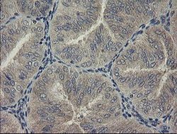 Invitrogen PHF7 Monoclonal Antibody (OTI1A11) 100 &mu;L | Buy Online | Invitrogen&trade; | Fisher Scientific