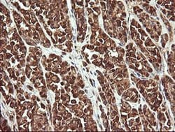 Invitrogen PROSC Monoclonal Antibody (OTI3A6) 100 &mu;L; Unconjugated:Antibodies,