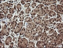 Invitrogen PROSC Monoclonal Antibody (OTI3A6) 100 &mu;L; Unconjugated:Antibodies,