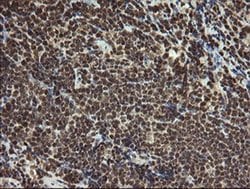 Invitrogen PROSC Monoclonal Antibody (OTI3A6) 100 &mu;L; Unconjugated:Antibodies,