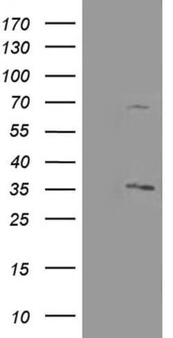 Invitrogen PROSC Monoclonal Antibody (OTI3A6) 100 &mu;L; Unconjugated:Antibodies,