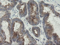 Invitrogen RIOK2 Monoclonal Antibody (OTI5D11) 100 &mu;L; Unconjugated:Antibodies,