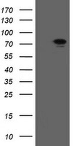 Invitrogen RIOK2 Monoclonal Antibody (OTI5D11) 100 &mu;L; Unconjugated:Antibodies,