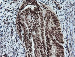 Invitrogen FATE1 Monoclonal Antibody (OTI1A1) 100 &mu;L; Unconjugated:Antibodies,