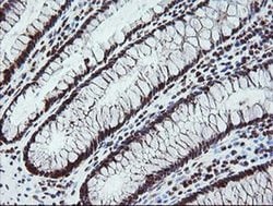Invitrogen FATE1 Monoclonal Antibody (OTI1A1) 100 &mu;L; Unconjugated:Antibodies,