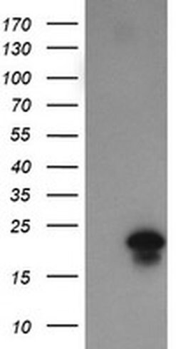 Invitrogen FATE1 Monoclonal Antibody (OTI1A1) 100 &mu;L; Unconjugated:Antibodies,