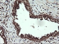 Invitrogen CGI-62 Monoclonal Antibody (OTI4B5) 100 &mu;L; Unconjugated:Antibodies,