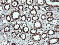 Invitrogen CGI-62 Monoclonal Antibody (OTI4C1) 100 &mu;L; Unconjugated:Antibodies,