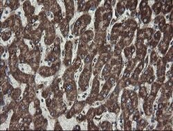 Invitrogen CGI-62 Monoclonal Antibody (OTI4C1) 100 &mu;L; Unconjugated:Antibodies,
