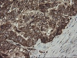 Invitrogen CGI-62 Monoclonal Antibody (OTI4C1) 100 &mu;L; Unconjugated:Antibodies,