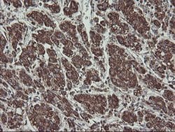 Invitrogen CGI-62 Monoclonal Antibody (OTI4C1) 100 &mu;L; Unconjugated:Antibodies,