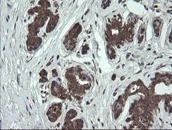 Invitrogen CGI-62 Monoclonal Antibody (OTI4C1) 100 &mu;L; Unconjugated:Antibodies,
