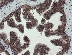 Invitrogen CGI-62 Monoclonal Antibody (OTI4C1) 100 &mu;L; Unconjugated:Antibodies,