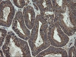 Invitrogen CGI-62 Monoclonal Antibody (OTI4C1) 100 &mu;L; Unconjugated:Antibodies,
