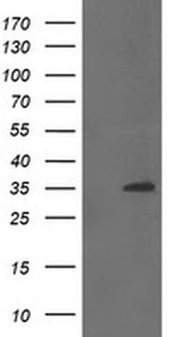Invitrogen CGI-62 Monoclonal Antibody (OTI4C1) 100 &mu;L; Unconjugated:Antibodies,