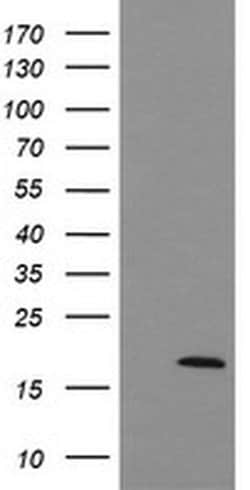 Invitrogen UBE2G2 Monoclonal Antibody (OTI4D6) 100 &mu;L; Unconjugated:Antibodies,