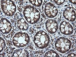 Invitrogen CESK1 Monoclonal Antibody (OTI1C1) 100 &mu;L; Unconjugated:Antibodies,