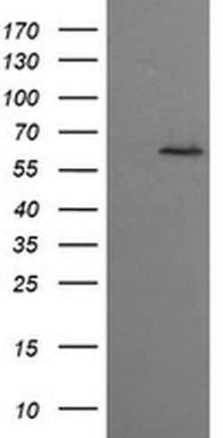 Invitrogen CESK1 Monoclonal Antibody (OTI1C1) 100 &mu;L; Unconjugated:Antibodies,