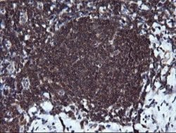 Invitrogen RAB37 Monoclonal Antibody (OTI2F1) 100 &mu;L; Unconjugated:Antibodies,