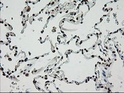 Invitrogen ZNF447 Monoclonal Antibody (OTI2H7) 100 &mu;L; Unconjugated:Antibodies,