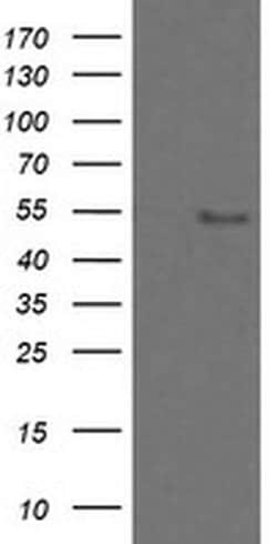 Invitrogen ZNF447 Monoclonal Antibody (OTI2H7) 100 &mu;L; Unconjugated:Antibodies,
