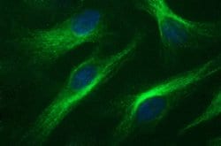 Invitrogen RAB37 Monoclonal Antibody (OTI2D1) 100 &mu;L; Unconjugated:Antibodies,