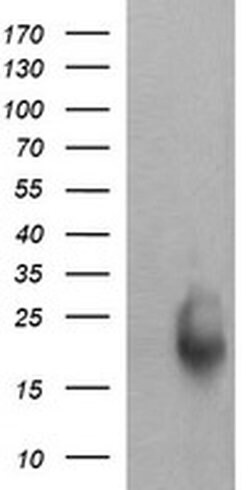 Invitrogen RAB30 Monoclonal Antibody (OTI3E7) 100 &mu;L; Unconjugated:Antibodies,